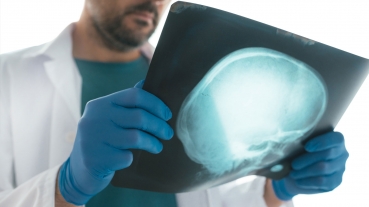 Błąd diagnostyczny – kazus nietrzeźwego pacjenta z urazem czaszkowo-mózgowym